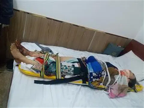 TP Hồ Chí Minh: Thang máy khách sạn rơi, một người phụ nữ bị thương nặng